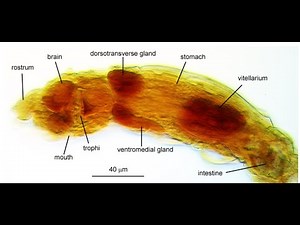 Rotifer bdeloid Philodina