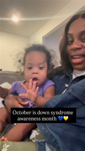 2.1K views · 1.9K reactions | Children with Down syndrome often...