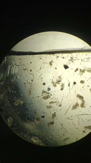 Zooplankton observation under the Microscope