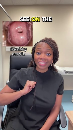 Understanding the Cervix: Anatomy and Health Insights