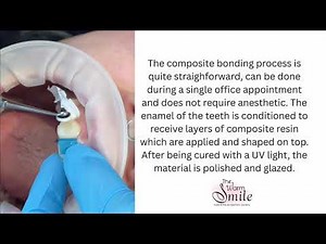 Composite bonding process