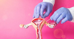 Ligature des trompes : prise de poids, règles, libido, irréversible ?