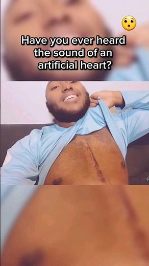 This Is What An Artificial Heart Sounds Like..😯