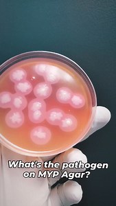 Guess the Microorganism on MYP Agar? A) Bacillus subtilis B) Bacillus cereus C) Bacillus pumiles D) Geobacillus stearothermophilus | Elmicrobiologist