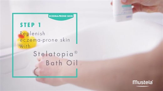 Watch Mustela Stelatopia Moisturizing Emollient Balm for Eczema-Prone Skin, 6.7 oz..Mustela stelatopia... on Amazon Live