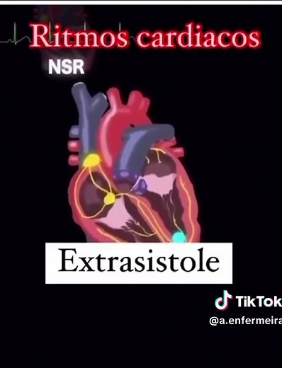 Conheça os Principais Ritmos Cardíacos