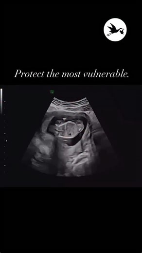 Human rights begin in the womb. | Save the Storks