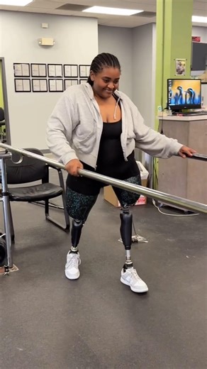 Walks with Kneuro Microprocessor Knees 🦿 Incredible Progress! Amputation #nevergiveup