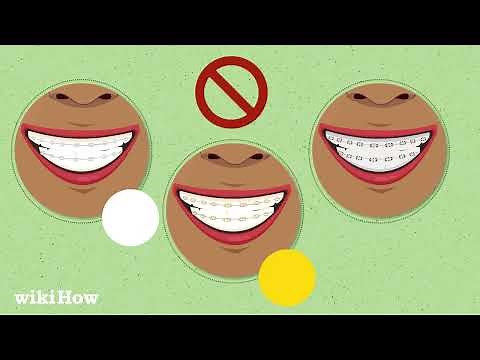 How to Choose the Best Braces Colors for You