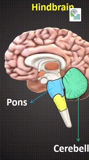 2 Types of Bleeding in Stroke 🧠
