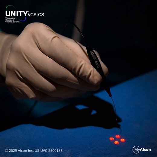 Introducing UNITY® TetraSpot - the first and only multi-spot illuminated laser probe that dramatically reduces laser application time up to 3.1 times, delivering 1, 2 or 4 spot versatility.¹* Designed for superior efficiency **, Unity® VCS sets our standard in vitreoretinal surgery. *MSLP(4) is 3 times faster than SSLP **Based on bench testing Discover more: https://www.myalcon.com/professional/unity/ #Alcon #AlconUS #UnityVCS #UnityCS #ItStartsWithU #ExperienceExtraordinary | MyAlcon Profession