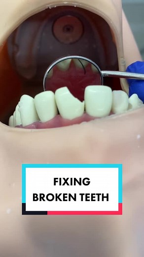 How dental students practice fixing broken front teeth! #BeautyHack #Science101
