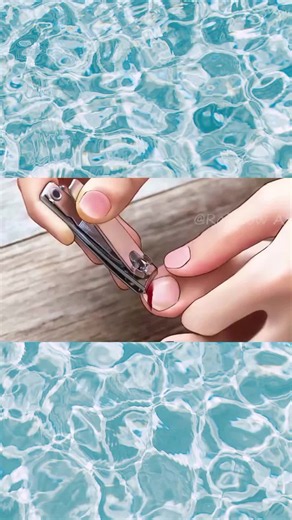 Asmr Nail care cleaning and treatment asmr animation #asmr #asmrtreatment #asmranimation