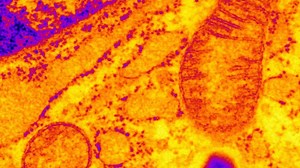 Cellular Defect Linked to Diabetes