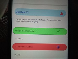 Question: Which patient position is most effective for identify... | Filo