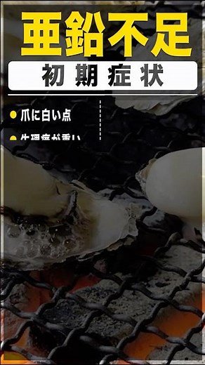 【放置厳禁】亜鉛不足の初期症状16選 #shorts