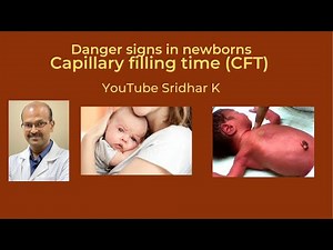 Capillary filling time. Capillary refill time. Dr Sridhar K