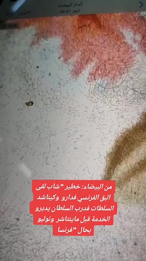 Close-Up Look at Insect on Textured Fabric Surface