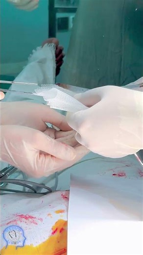 What is mesh for Hernia Repair