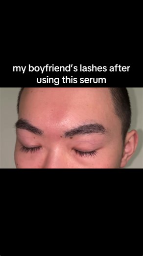 #lashes #lashserum