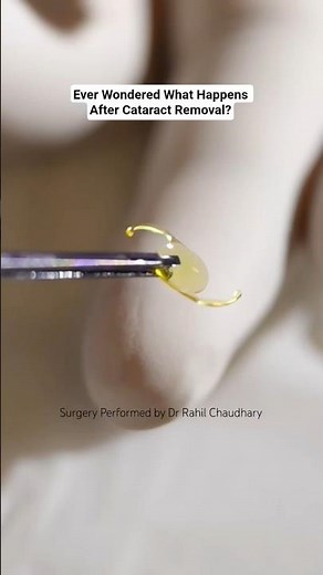 Ever Wonder What Happens After Cataract Removal?