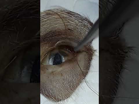 Temporary Tarsorrhaphy