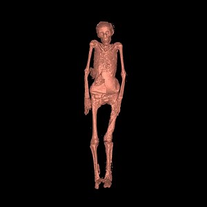 Scan reveals mummy's true age
