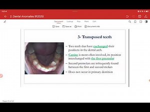 Anomalies in position of teeth and it's structure(Amelogenesis Imperfect.2.Dentinogenesis imperfecta