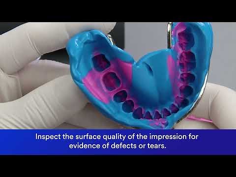 Imprint 4 Impression Technique with 3M