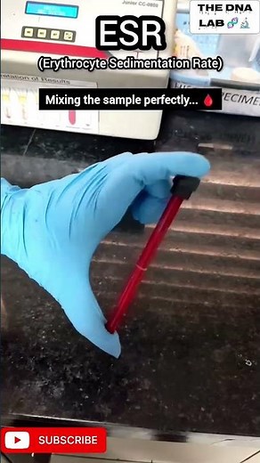 ESR Test Machine Practical | Easy Method for Beginners🩸🩸#ESRtest#laboratory #hematology #shorts