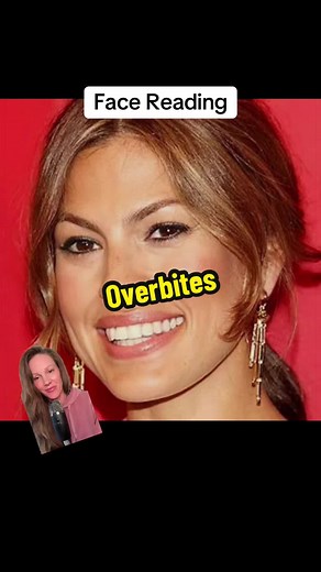 Overbites = childhood deprivation in face reading. #facereading #face #mouth #teeth #overbite