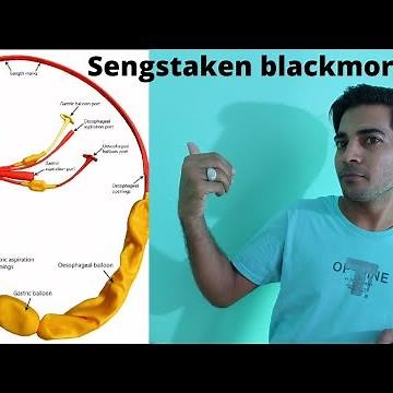 Sengstaken blackmore tube/gastric tube