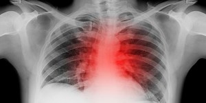 Doctors Reveal the Number-1 Sign of Heart Failure You Should Never Ignore