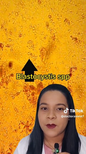 Understanding Blastocystis spp and Parasitology: Symptoms, Treatment, and More