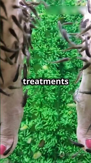 The Doctor Fish | Amazing Facts About Garra Rufa Fish #shorts