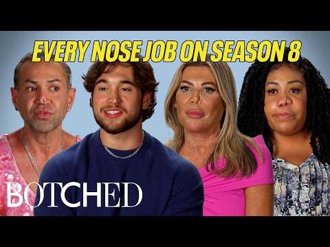 Every Nose Job on Botched Season 8 (All Surgeries) | Supercut Compilation | Botched | E!