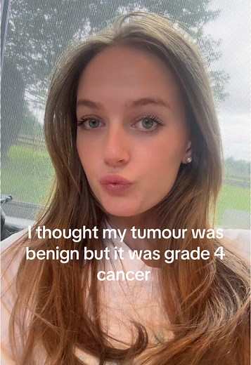 Understanding Grade 4 Brain Cancer Symptoms