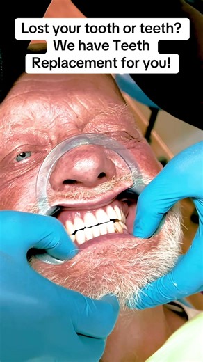 Effective Teeth Replacement Solutions at iDentalCare