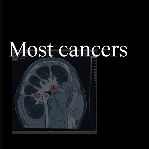 Cancer isn’t just bad luck. There’s a lot you can do to lower your risk—and it goes beyond just eating well and exercising. At Everlab, we use advanced diagnostics to analyse your genetics and biomarkers, helping you take real action to prevent disease or detect it early. ✔️ 30% of members uncover unexpected risks ✔️ 8% detect life-threatening heart conditions Don’t leave your health to chance. Take control today. | Everlab