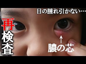 【眼科再受診】瞼の腫れが原因？嘔吐で幼稚園早退 風邪の引き始め… みっぱちゃんfamily vlog