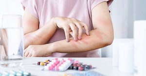 Alergia ao frio? Saiba o que é, veja os sintomas e como tratar