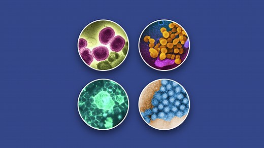 How long does Norovirus last? Plus, can you get it again?