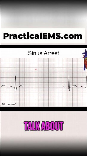 EKG Explained: Spotting Sinus Blocks & Arrests Instantly! #shorts