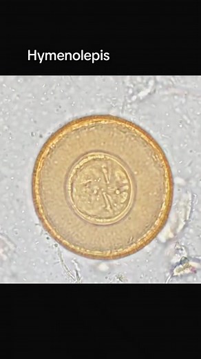 108K views · 1.8K reactions | Stool sample  #lablife #microbiology | Lab life | Facebook