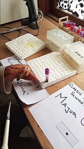 🩸 Major Crossmatch in Blood Banking Explained | Step-by-Step Guide 🧪 #mlt #science