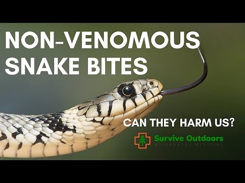 SNAKE BITE Medical Treatment - Non Venomous Snake Bites