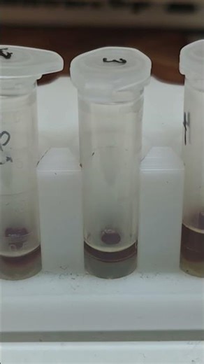 DNA extraction and purification using magnetic beads #dna #biotech #ukraine
