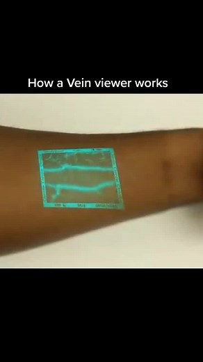 Understanding Infrared Vein Viewer Technology