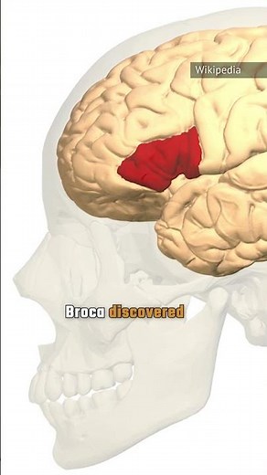 Types Of Aphasia Explained #Aphasia #Brain #Neurology