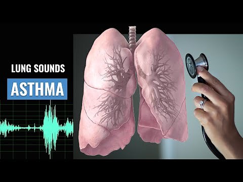 Asthma Lung sound | Wheezing | Asthma | Christina NP | Caring Casa
